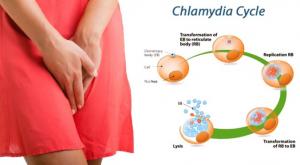 صورة: التعرف على أعراض الكلاميديا لدى النساء