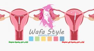 إخراج لولب من الرحم صورة: إخراج لولب من الرحم
