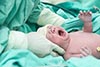 اعراض رتق المريء