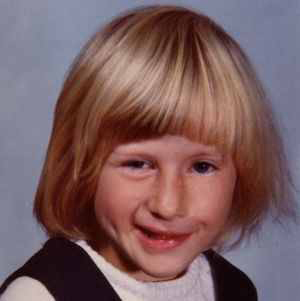 صورة: أعراض ألتهاب العصب السابع عند الأطفال