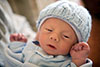 التثلث الصبغي Trisomy وأنواعه