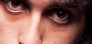 صورة: السواد تحت العين و أسباب السواد تحت العين