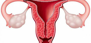 صورة: بطانة الرحم و طبقات بطانة الرحم و تغيرات بطانة الرحم خلال الدورة الشهرية