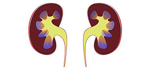 صورة: أنواع التهاب الكلية و أعراض التهاب الكلى
