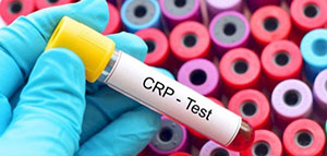 صورة: تعريف تحليل CRP و اختبار البروتين المتفاعل C عالي الحساسية