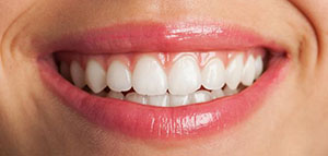 صورة: أعراض التهاب اللثة و أعراض تستوجب زيارة الطبيب