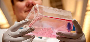 صورة: الحبوب و أسباب ظهور حبوب حمراء على الرقبة