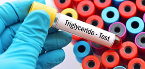 صورة: تحليل الدهون الثلاثية و دواعي إجراء تحليل الدهون الثلاثية