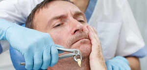 طرق خلع السن و خطوات خلع الأسنان و أسباب خلع الأسنان صورة: طرق خلع السن و خطوات خلع الأسنان و أسباب خلع الأسنان