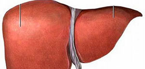 صورة: احتقان الكبد و أعراض احتقان الكبد و الأسباب