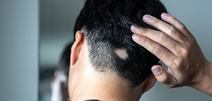 صورة: العلاجات الدوائية و العلاجات الطبيعية