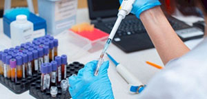 صورة: تحليل المعادن الثقيلة في الجسم