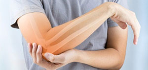 صورة: وصفات طبيعية لتخفيف هشاشة العظام