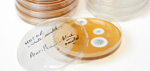 صورة: كيف اكتشف ألكساندر فليمنج البنسلين و كيف تحول البنسلين إلى دواء