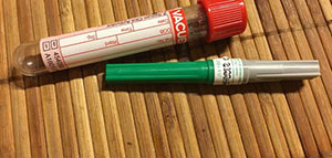 صورة: تحليل البرولاكتين و أسباب إجراء تحليل البرولاكتين